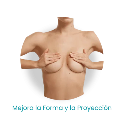 Mamoplastia -Forma
