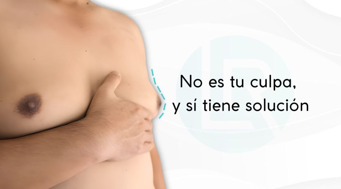 Ginecomastia-Guia-Medica-Clara-y-Comprensible-DRLEONARDORUED