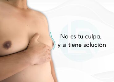 Ginecomastia: Guía Médica Clara y Comprensible
