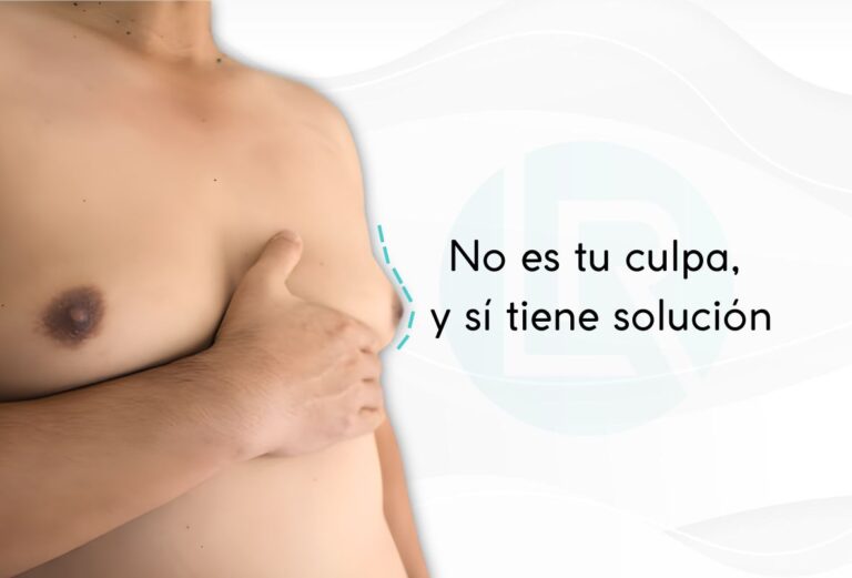 Ginecomastia-Guia-Medica-Clara-y-Comprensible-DRLEONARDORUED