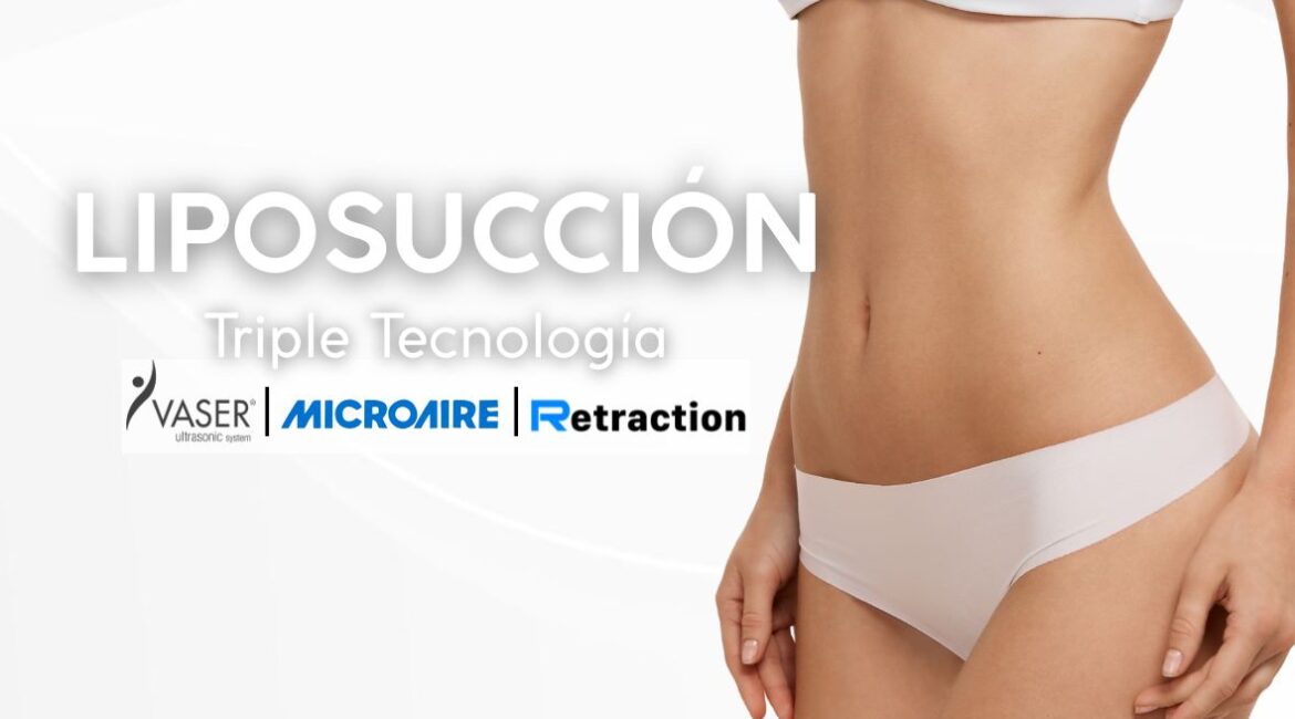 Liposucción con Triple Tecnología - DR LEONARDO RUEDA-2
