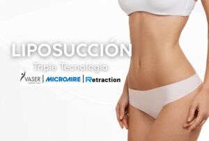 Liposucción con Triple Tecnología - DR LEONARDO RUEDA-2