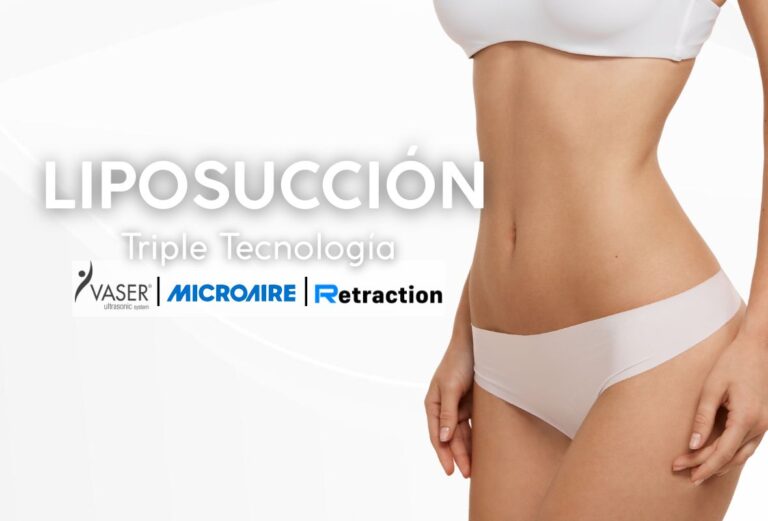 Liposucción con Triple Tecnología - DR LEONARDO RUEDA-2