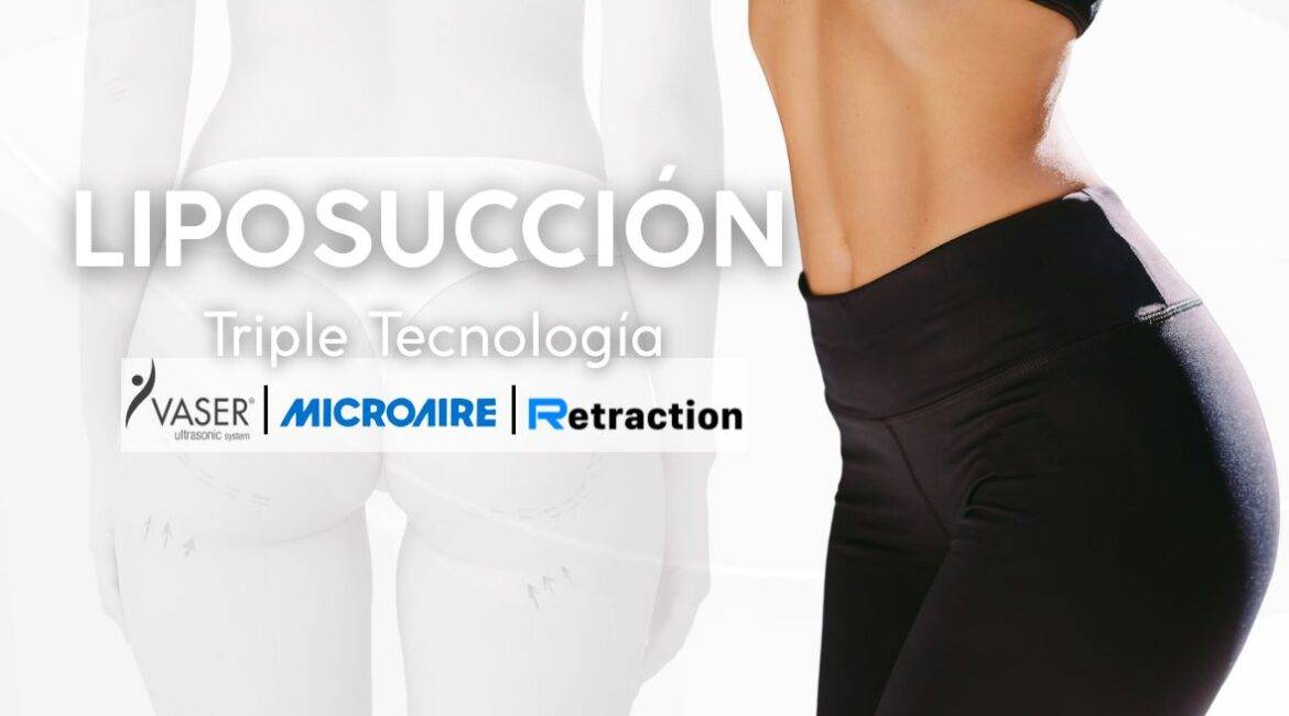 LIPOSUCCIÓN EN COLOMBIA