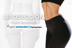 LIPOSUCCIÓN EN COLOMBIA