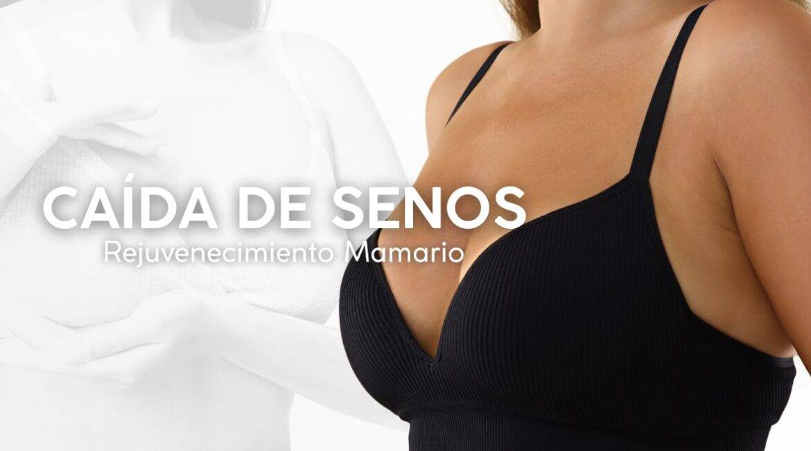 CAÍDA DE SENOS REJUVENECIMIENTO MAMARIO (1)