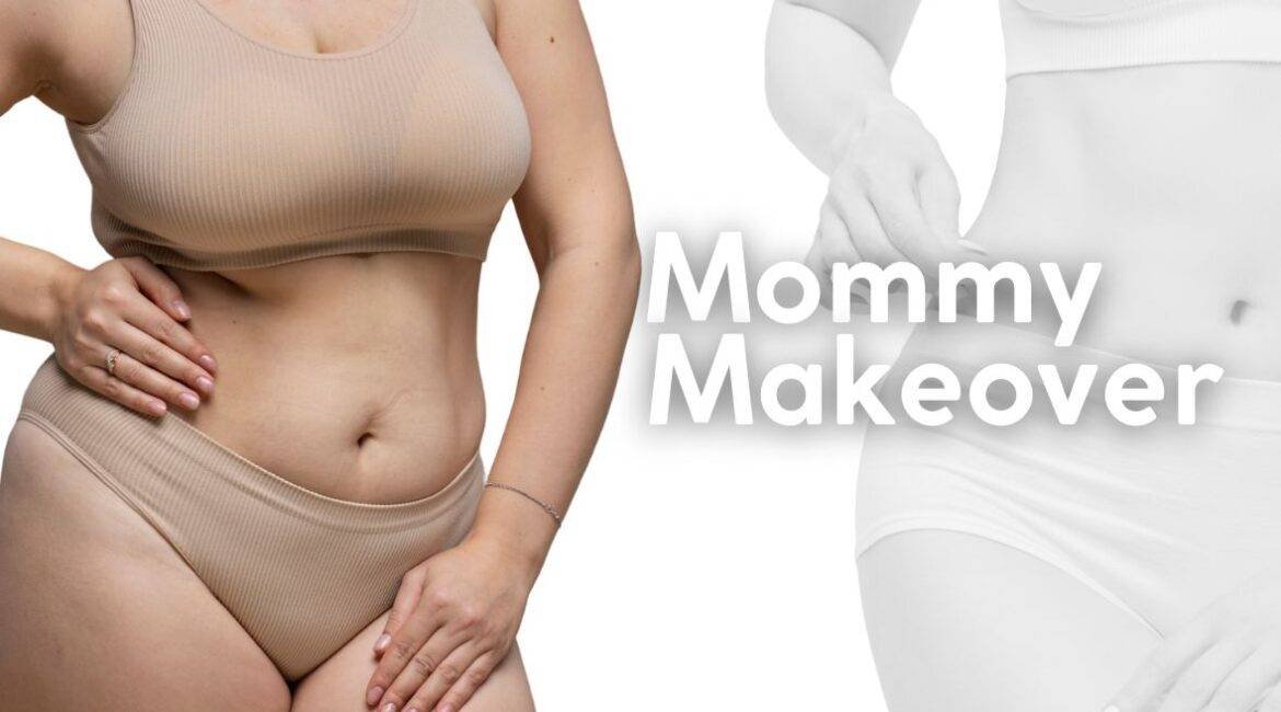 Mommy Makeover ¿qué procedimientos puede incluir112