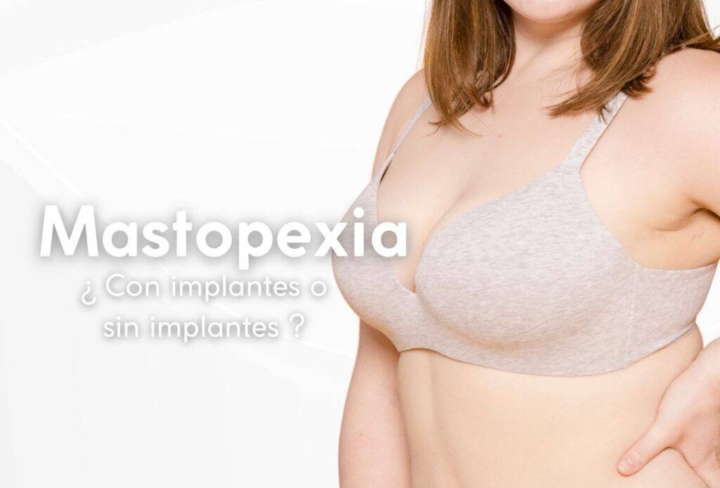mastopexia con implantes o sin implantes