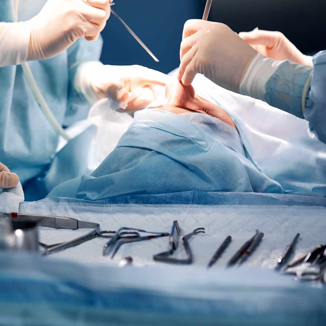 Mamoplastia (5)